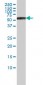 PSMD5 Antibody (monoclonal) (M01)